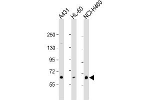 Western Blotting (WB) image for anti-Protein Kinase C, eta (PRKCH) antibody (ABIN3002933) (PKC eta anticorps)