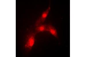 Immunofluorescent analysis of MDM2 (pS166) staining in MCF7 cells.