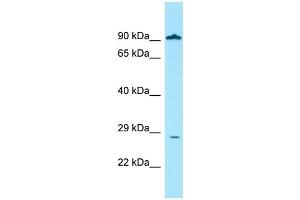 WB Suggested Anti-GLIPR1 Antibody Titration: 1. (GLIPR1 anticorps  (Middle Region))