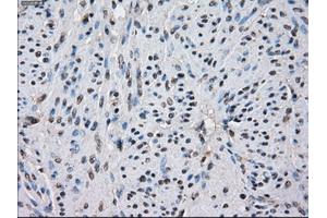 Immunohistochemical staining of paraffin-embedded colon tissue using anti-IDH1 mouse monoclonal antibody. (IDH1 anticorps)