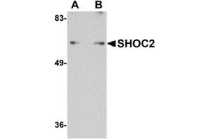 Western Blotting (WB) image for anti-Leucine-rich repeat protein SHOC-2 (SHOC2) (N-Term) antibody (ABIN1031560) (SHoc2/Sur8 anticorps  (N-Term))