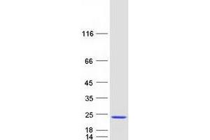 Validation with Western Blot