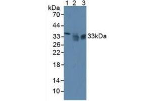Western blot analysis of (1) Mouse Liver Tissue, (2) Human HeLa cells and (3) Human PC-3 Cells. (SIRT4 anticorps  (AA 26-333))