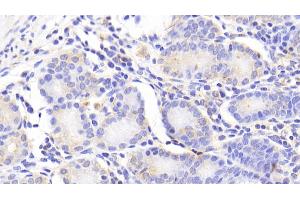 Detection of NUTF2 in Human Stomach Tissue using Polyclonal Antibody to Nuclear Transport Factor 2 (NUTF2)