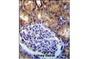 MLLT7 antibody (N-term) (ABIN390133 and ABIN2840637) immunohistochemistry analysis in formalin fixed and paraffin embedded human kidney tissue followed by peroxidase conjugation of the secondary antibody and DAB staining. (FOXO4 anticorps  (N-Term))