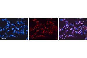 NR2F6 antibody - N-terminal region          Formalin Fixed Paraffin Embedded Tissue:  Human Lung Tissue    Observed Staining:  Nucleus of pneumocytes   Primary Antibody Concentration:  1:100    Other Working Concentrations:  1/600    Secondary Antibody:  Donkey anti-Rabbit-Cy3    Secondary Antibody Concentration:  1:200    Magnification:  20X    Exposure Time:  0.