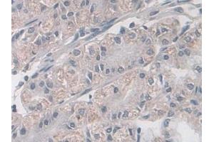 Detection of TACR2 in Human Stomach Tissue using Polyclonal Antibody to Tachykinin Receptor 2 (TACR2)