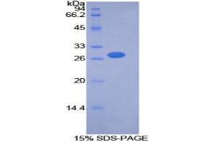 SDS-PAGE (SDS) image for Pyruvate Dehydrogenase Kinase, Isozyme 2 (PDK2) (AA 155-379) protein (His tag) (ABIN2126590) (PDK2 Protein (AA 155-379) (His tag))