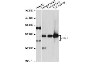 Western blot analysis of extracts of various cell lines, using NNT antibody (ABIN5972604) at 1:3000 dilution. (NNT anticorps)