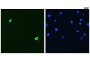Frozen sections of human testis stained with P2B1.