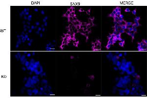 Immunocytochemical staining of HeLa cells using SNX9 antibody (ABIN7800412), 1:1,000), Top panel: wild-type (WT), Bottom panal: SNX9 shRNA knockdown (KD).