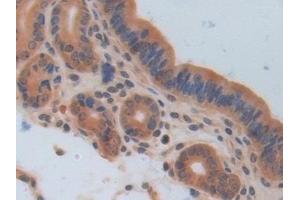 Detection of IL17RA in Mouse Uterus Tissue using Polyclonal Antibody to Interleukin 17 Receptor A (IL17RA) (IL17RA anticorps  (AA 590-848))