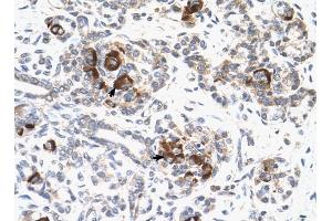 MAP2K2 antibody was used for immunohistochemistry at a concentration of 4-8 ug/ml to stain Epithelial cells of pancreatic acinus (arrows) in Human Pancreas.