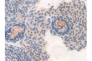 Detection of PDXK in Mouse Ovary Tissue using Polyclonal Antibody to Pyridoxal Kinase (PDXK)