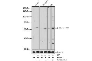 Western blot analysis of extracts of various cell lines, using Phospho--T308 antibody (ABIN3020075, ABIN3020076, ABIN3020077 and ABIN6225508) at 1:500 dilution. (AKT1 anticorps  (pThr308))