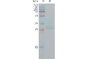 Human N Protein, hFc Tag on SDS-PAGE under reducing condition.