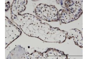 Immunoperoxidase of monoclonal antibody to MYST3 on formalin-fixed paraffin-embedded human placenta. (MYST3 anticorps  (AA 81-179))