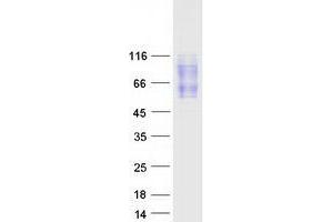 Validation with Western Blot