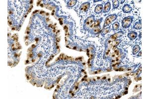 IHC analysis of MUC2 using anti-MUC2 antibody (ABIN7600606).