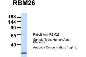 Host:  Rabbit  Target Name:  RBM26  Sample Type:  Human Adult Placenta  Antibody Dilution:  1. (RBM26 anticorps  (Middle Region))