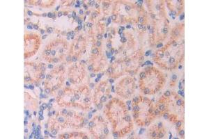 Used in DAB staining on fromalin fixed paraffin- embedded kidney tissue