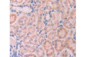 Used in DAB staining on fromalin fixed paraffin- embedded kidney tissue (Ladinin 1 anticorps  (AA 1-140))
