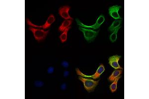 ABIN6257219 and ABIN6276016 staining Hela cells by IF/ICC.