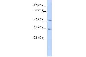 WB Suggested Anti-DHODH Antibody Titration:  0. (DHODH anticorps  (Middle Region))