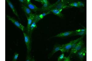 Immunofluorescence (Cultured Cells) (IF (cc)) image for anti-Fibronectin (AA 1201-1300) antibody (ABIN671646)
