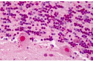 Human Brain, Cerebellum: Formalin-Fixed, Paraffin-Embedded (FFPE) (RBX1 anticorps  (C-Term))