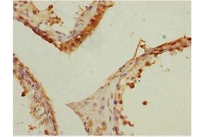 Immunohistochemistry of paraffin-embedded human testis tissue using ABIN7150536 at dilution of 1:100 (DNAJB9 anticorps  (AA 24-223))