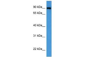 Western Blotting (WB) image for anti-Oxysterol Binding Protein (OSBP) (C-Term) antibody (ABIN2788369) (OSBP anticorps  (C-Term))