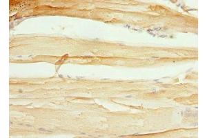 Immunohistochemistry of paraffin-embedded human skeletal muscle tissue using ABIN7148782 at dilution of 1:100