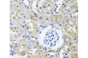 Immunohistochemistry of paraffin-embedded Rat kidney using ITPKB Polyclonal Antibody at dilution of 1:100 (40x lens).