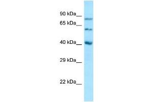 Western Blotting (WB) image for anti-Sulfatase Modifying Factor 1 (SUMF1) (N-Term) antibody (ABIN2789756) (SUMF1 anticorps  (N-Term))