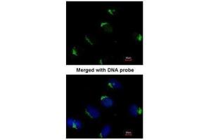 ICC/IF Image Immunofluorescence analysis of paraformaldehyde-fixed HeLa, using Bag1, antibody at 1:200 dilution. (BAG1 anticorps)