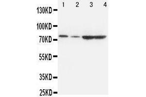 Western Blotting (WB) image for anti-Proprotein Convertase Subtilisin/kexin Type 9 (PCSK9) (AA 671-687), (C-Term) antibody (ABIN3042887) (PCSK9 anticorps  (C-Term))