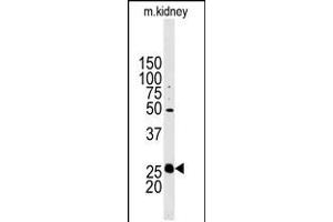Western blot analysis of anti-STC2 Antibody in mouse kidney tissue lysates (35ug/lane). (Stanniocalcin 2 anticorps  (N-Term))