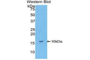 Western Blotting (WB) image for anti-gamma-Interferon-Induced Monokine (CXCL9) (AA 23-125) antibody (ABIN5662055)