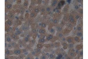 Detection of GSTt2 in Mouse Liver Tissue using Polyclonal Antibody to Glutathione S Transferase Theta 2 (GSTt2)