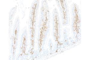 Immunohistochemistry (IHC) image for anti-CD48 (CD48) (AA 23-216) antibody (ABIN7795673) (Recombinant CD48 anticorps  (AA 23-216))