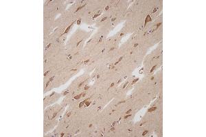 Immunohistochemical analysis of C on paraffin-embedded Human brain tissue.