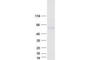Validation with Western Blot