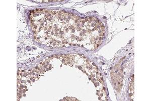 ABIN6266523 at 1/200 staining human testis tissue sections by IHC-P. (Cyclin A1 anticorps  (C-Term))