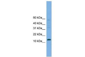 Western Blot showing CRABP2 antibody used at a concentration of 1-2 ug/ml to detect its target protein. (CRABP2 anticorps  (Middle Region))