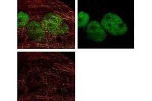 STED Immunofluorescence Microscopy - Dylight 488 conjugated antibody 488 conjugated anti-Rabbit IgG was used to demonstrate 2 color STED immunofluorescence microscopy. (Chèvre anti-Lapin IgG (Heavy & Light Chain) Anticorps (DyLight 488) - Preadsorbed)