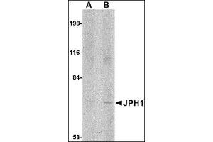 Western blot analysis of JPH1 in 293 cell lysate with this product at (A) 1 and (B) 2 μg/ml. (Junctophilin 1 anticorps  (C-Term))