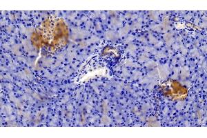 Detection of INSR in Mouse Pancreas Tissue using Polyclonal Antibody to Insulin Receptor (INSR)