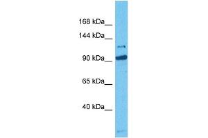 Host:  Rabbit  Target Name:  MORC3  Sample Tissue:  Human HCT116 Whole Cell  Antibody Dilution:  1ug/ml (MORC3 anticorps  (C-Term))