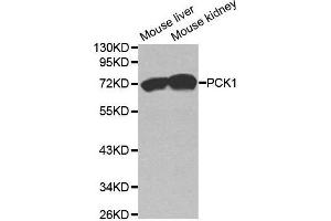 Western blot analysis of extracts of various cell lines, using PCK1 antibody. (PCK1 anticorps  (C-Term))